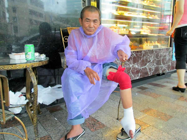 阿源，是一位大半輩子在工地做粗工的人，因為從鷹架上摔下來，膝蓋跟腳踝骨折，變成了這副模樣。