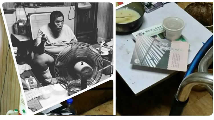 他住在這個小屋裡，獨自一人，雙腳嚴重的蜂窩性組織炎，傷口潰爛烏黑