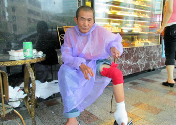 阿源，是一位大半輩子在工地做粗工的人，因為從鷹架上摔下來，膝蓋跟腳踝骨折，變成了這副模樣。